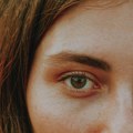 Skincare rutina za kožu sklonu hiperpigmentaciji