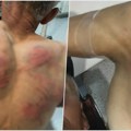 Srpska lista: Kosovska policija upala u kuću Nenada Raškovića, tukla ga, vezala za drvo i tražila da prizna ratni zločin (FOTO)…