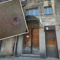 "Imam crne kratere na koži": Beograđanka otišla na rutinsku intervenciju, završila u ožiljcima: Ordinacija radi bez…