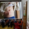 Познато стање оболеле деце у новом пазару: Трећи случај морбила регистрован код детета које се вратило из Босне