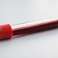 Najsmrtonosnija epidemija ebole u istoriji Konga: preminulo 2.325 ljudi