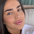(Foto) Anđela Đuričić se sprema za "Elitu 10" Osvanuo video sa nove estetske korekcije, javnost zgrožena a komentari nikad…
