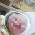 "Ако крене да плави или се гуши..." Искра Брајовића о здравственом проблему сина: "Срце му се зацелило сада"