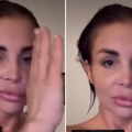 Mađarica pokazala unakaženo lice nakon Beograda: Dobila je pet šamara i izgubila titulu u Areni