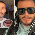 Estradni frizer koji je umro na Badnji dan imao problem sa zubima! 2 meseca pred smrt pričao kroz šta prolazi