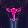 'Nevidljivi invaliditet': Šta je endometrioza i kako se leči na Balkanu