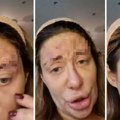 Neka neko pomogne ovoj ženi: Osvanuo snimak Ane Nikolić sa jezivim ranama na licu