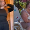 Mia je uz MAUNDžARO smršala 38 kilograma, ali pati od ovih simptoma Neželjeni efekti brojni jedan je posebno neprijatan
