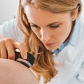 U Srbiji više od 700 ljudi godišnje dobije rak kože: Ovi pacijenti imaju veći faktor rizika