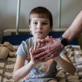 Potresna priča o dečaku (11) iz Harkova, on je primer hrabrosti: "Saško je držao odsečenu nogu uz telo da zaustavi…