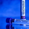 Tabaro: U Francuskoj za sada neće biti restrikcija putovanja zbog hantavirusa