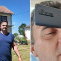 Milan tvrdi da ima natprirodne moći: U snu mu se otkrila čudna sposobnost, a struja mu ne može ništa (foto)
