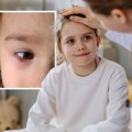 Majka primetila da joj ćerka (3) ima čudan sjaj u oku: Ispostavilo se da boluje ove od teške bolesti