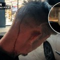 Napali imama u Zrenjaninu: Udarili ga u glavu i oteli sandžačku zastavicu