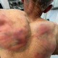 Srbin brutalno pretučen kod Zubinog Potoka: Tzv. kosovska policija tražila da prizna navodni ratni zločin