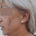 Stravičan snimak nasilja u Sremskoj Mitrovici ženu bivši partner ujeo za obraz (video)