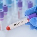 Institut za javno zdravlje Srbije nastavlja akciju besplatnog PSA testiranja