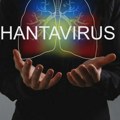 Kako se širi andski hantavirus i šta je naučeno iz epidemije u Argentini 2018. godine?