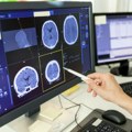 Raste važnost neurologije za individualno i populacijsko zdravlje