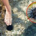 Tri šiljka probijaju kožu u Jadranu: Otrovni su i izazivaju jak bol, doktor otkriva šta je hitan spas na plaži
