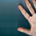 Najnovija studija: Dužina prstiju ukazuje na potencijalne psihičke poremećaje