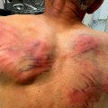 Тзв. косовска полиција брутално пребила Србина: Везали га за дрво и тукли цревом за воду