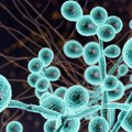 Otkrivena povezanost gljivica koje izazivaju vaginalne infekcije i Alchajmerove bolesti