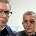 Tužilaštvo se ne oglašava povodom povređivanja policajca Lazara Baćića ispred RTS-a