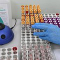 Sprovedeno prvo ispitivanje genske terapije radi podmlađivanja ćelija