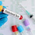 Nova studija: Većina ljudi sa naslednim visokim holesterolom ne zna da ga ima