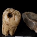 Tim naučnika otkrio da su neandertalci mogli da izvode stomatološke intervencije