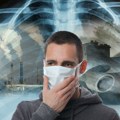 U našoj zemlji na svaka dva sata, rak pluća odnese jedan život! Dr Mihailo Stjepanović otkriva ko je najugroženija grupa i…