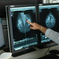 Za Žene ultrazvuk dojke, a muškarcima PSA test: Besplatni pregledi u nedelju, 10. decembra u Domu zdravlja na Limanu u Novom…