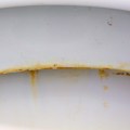 Užasne tamne fleke u WC šolji kao od šale skida ova jeftina namirnica – ostavite je preko noći, ujutru biće sve kao novo