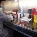 Besplatno u batutu: Akcija testiranja muškaraca tumor markerom specifičnim za prostatu, pogledajte termine