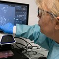 U Rusiji razvijen sistem za automatsko otkrivanje metastaza kolorektalnog raka