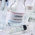 Epidemiolog Radovanović o riziku od izbijanja lepre u Srbiji: Bezbedni smo, guba pripada prošlosti što se nas tiče