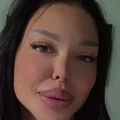 Маја Маринковић оперисана, извадила силиконе из задњице: Два пута пуцали, објављена прва слика