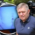 (Foto) Robert Fico pokazao iskasapljen stomak: Ovo su posledice atentata, njegova stranka za sve optužila opoziciju i novinare