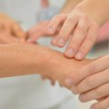 Nova nada za obolele od multiple skleroze: AI pronašao hiljade nevidljivih oštećenja mozga