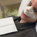 „Uništili su mi nos, dosta ljudi se javilo…“ Pevačici lekari unakazili nos, objavila slike, sva u zavojima