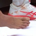 Novakovi problemi u Ženevi: Morali da mu leče žuljeve
