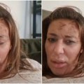 Ana Nikolić objavila uznemirujući snimak: "Sva sam u modricama, izubijana, ide mi krv sa svih strana"