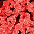 Proteini u krvi mogu upozoriti na kancer sedam godina pre dijagnoze
