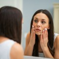 Gnojne akne nisu samo estetski problem: Hormonske promene mogu da budu okidači