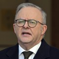 Албанезе одбацио сугестије да аустралијски амбасадор у САД постаје проблем