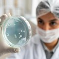 Hantavirus izazvao paniku u svetu Počinje kao grip, a može da ima teške posledice! Evo kako da prepoznate prve simptome
