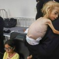 Katastrofa u gazi! Oglasio se UNHCHR: Rizik od gladi prisutan svuda u Pojasu Gaze