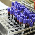 Svake godine od sepse umre oko 11 miliona ljudi - novi test krvi uz korišćenje AI tehnologije bi mogao da pomogne