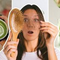 Skoro ostala bez kose zbog čaja Influenserke tvrde da im kosa opada dermatolozi imaju objašnjenje